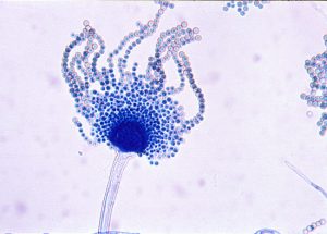 Saving plants from the enemy, Aspergillus flavus, and its toxic ...